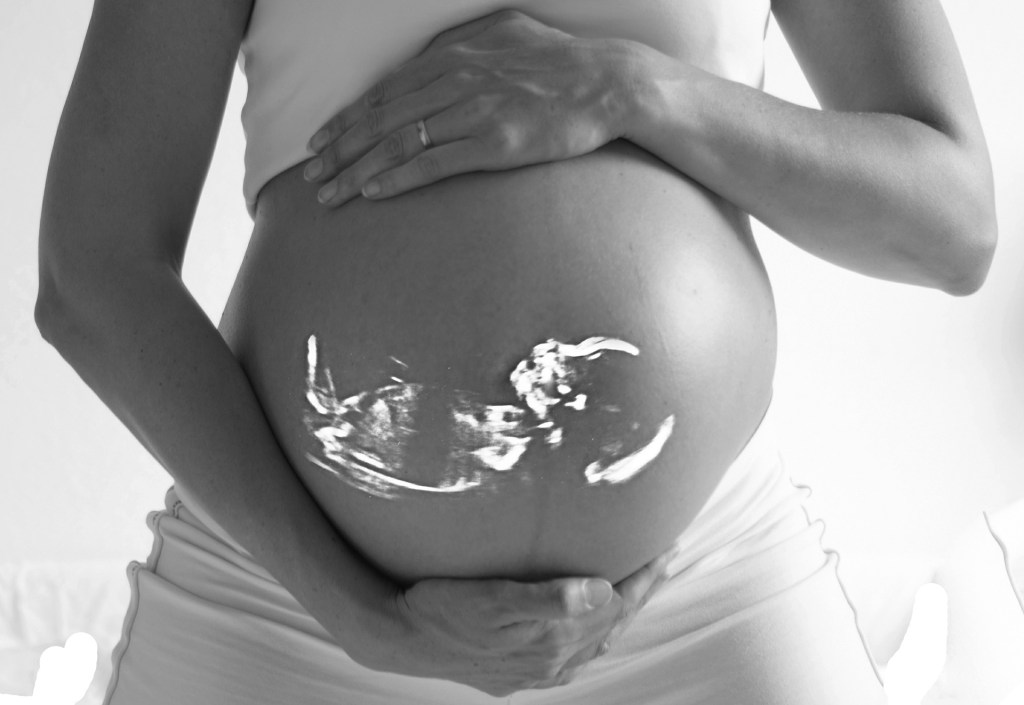 A Pro-Lifer Should Not Vote For A Jackbooted Defender Of Killing The Unborn